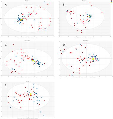 Comprehensive Metabolic Signature of Renal Dysplasia in Children. A Multiplatform Metabolomics Concept